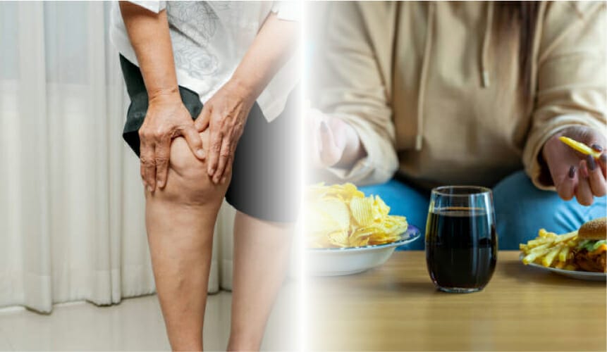 left photo: a woman a woman standing with leg cramp. right photo: person eating unhealthy foods such as chips soft drinks burger. 